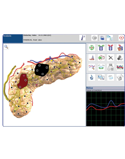 NEO EDEN TECH  Health and Wellness Analysis Detector,  Printer Report  for  Nutrition Kinetics and  Wellness System